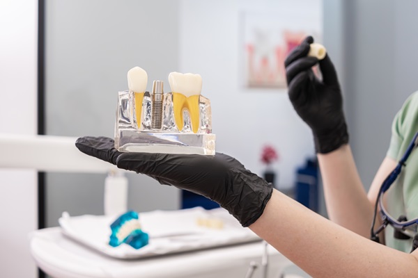Eating And Speaking With Dental Implants