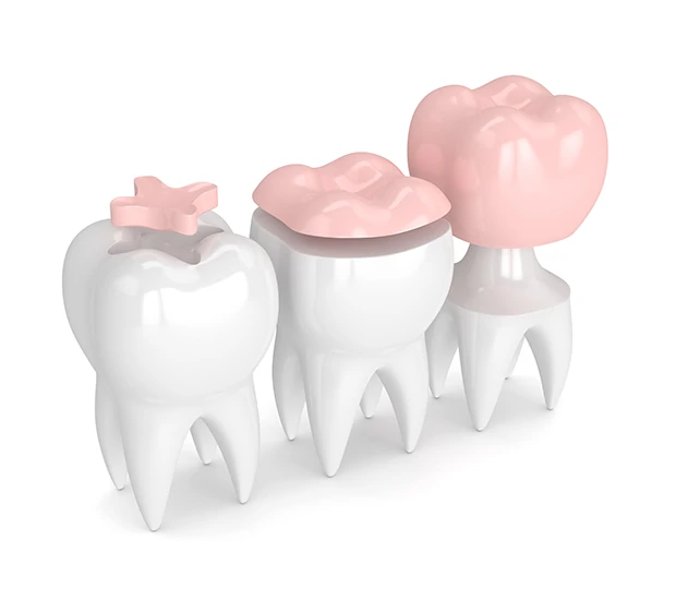 South Bend Dentist