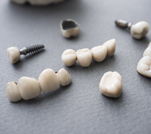 South Bend The Difference Between Dental Implants and Mini Dental Implants