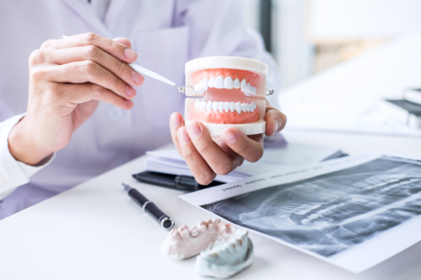 Can Multiple Teeth Need A Root Canal?