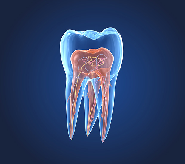 South Bend What is an Endodontist